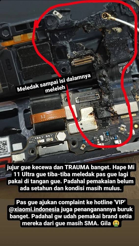 Meledak di Tangan, HP Xiaomi Rp17 Jutaan Tak Dapat Garansi